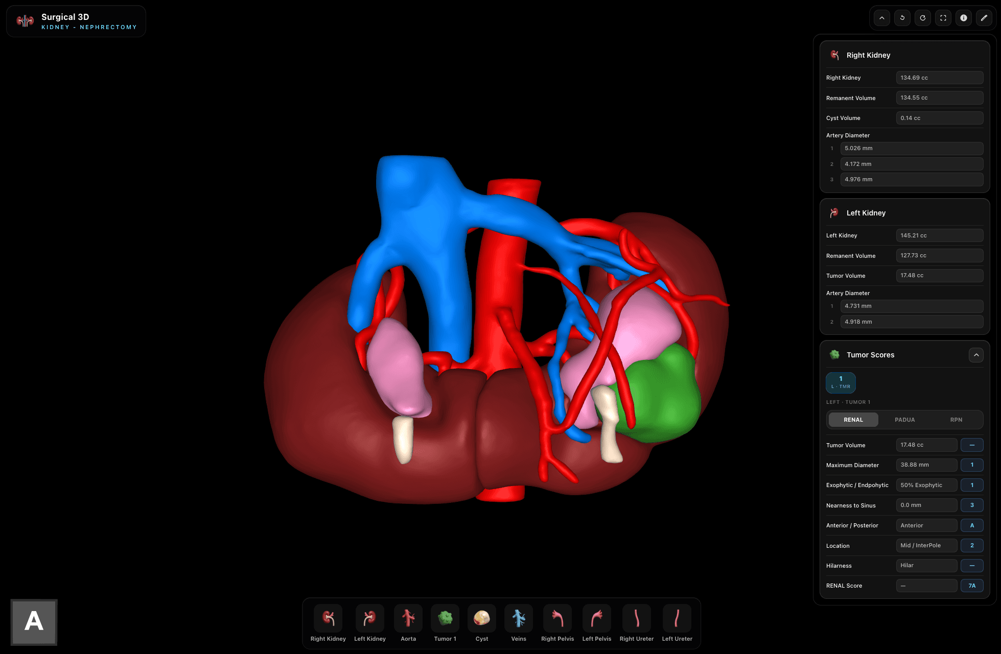 Kidney render preview