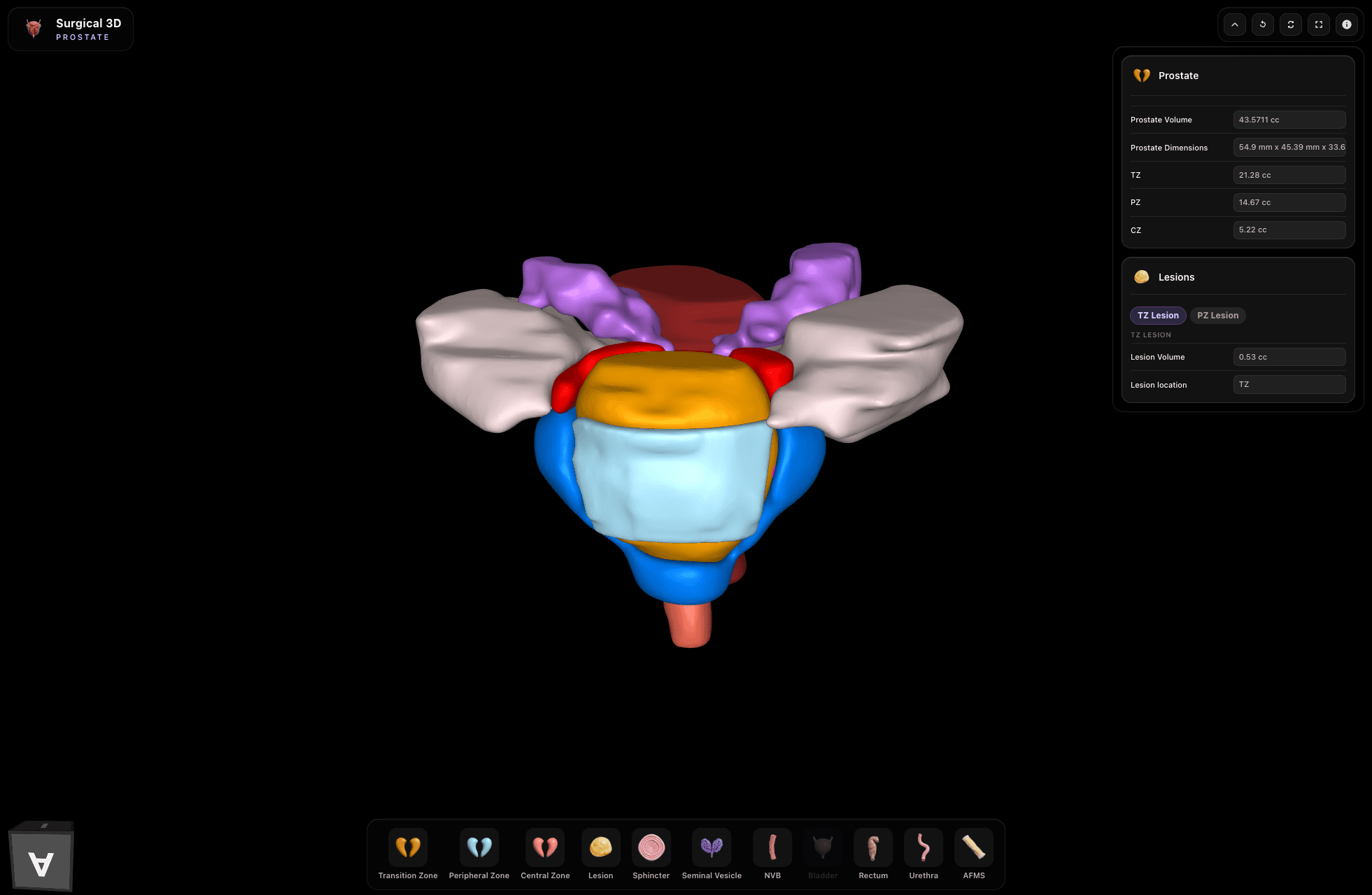 Prostate render preview